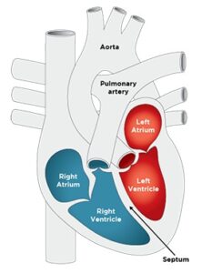 Heart Ventricles